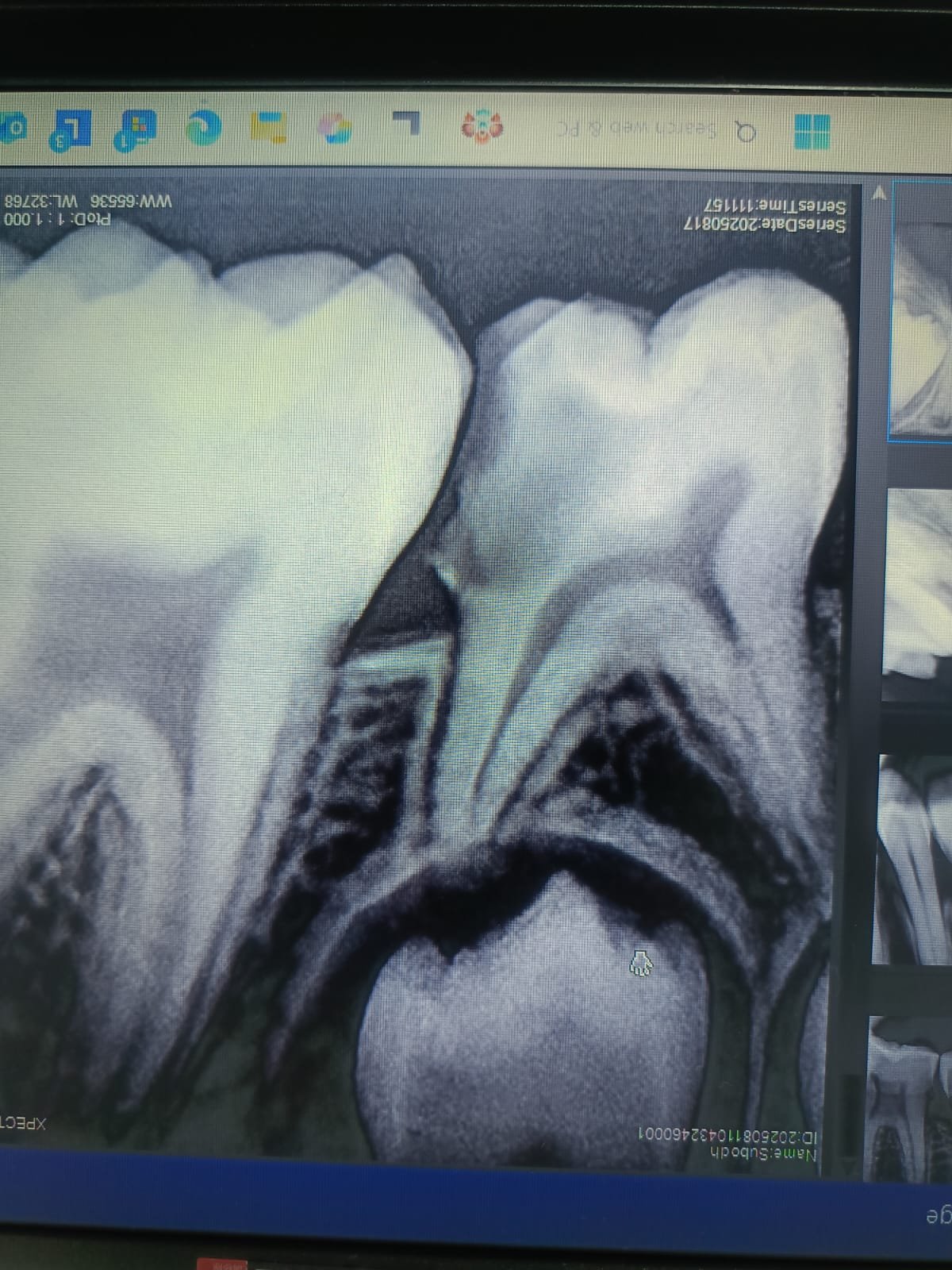 Patient resting comfortably in the dental chair with apron during treatment